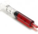Nabelschnurblut - F�r die Zukunft sichern?