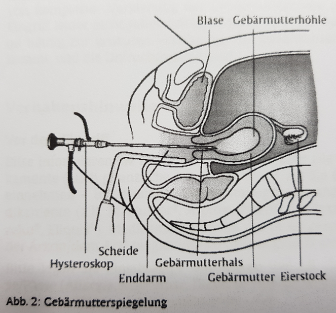 Tagebuch Kinderwunsch: Lina