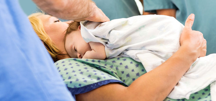 Kaiserschnitt nach Narbenbehandlung nach