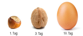 Magengröße eines Neugeborenen