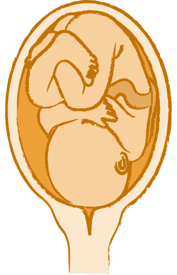 Im 9. Monate dreht sich das Baby im Mutterleib in die Schädellage Im 9. Monate dreht sich das Baby im Mutterleib in die Schädellage